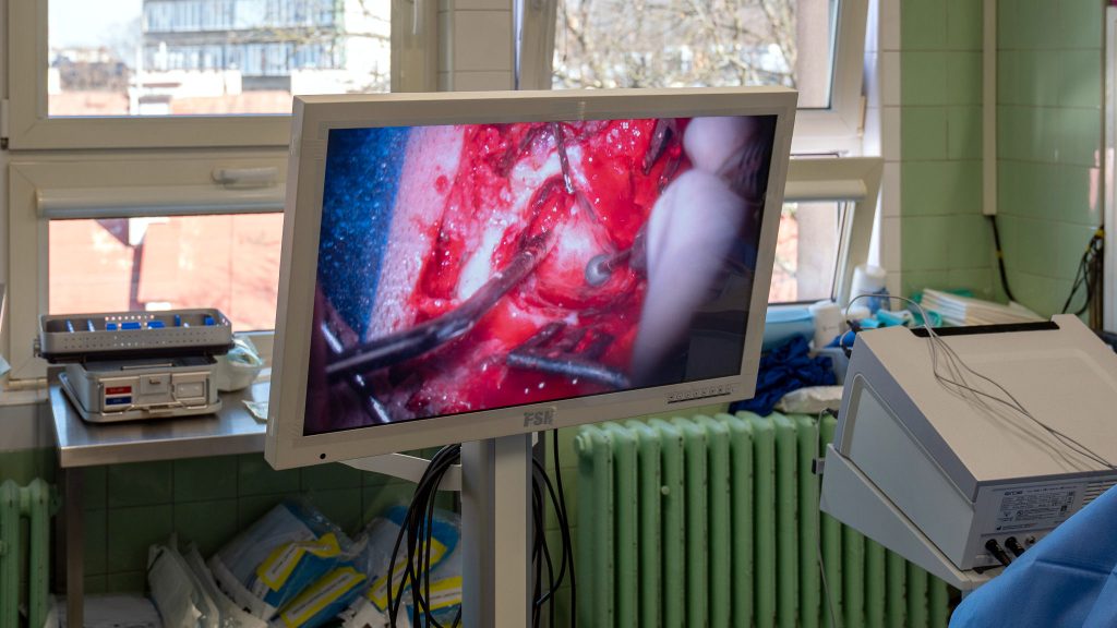 Zabieg wszczepienia implantu do ucha