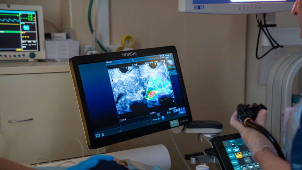 Termoablacja trzustki