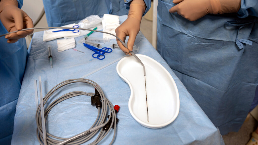 Krioablacja guza nerki